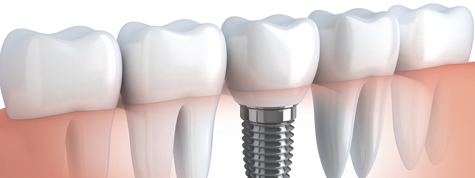 Maine Periodontics